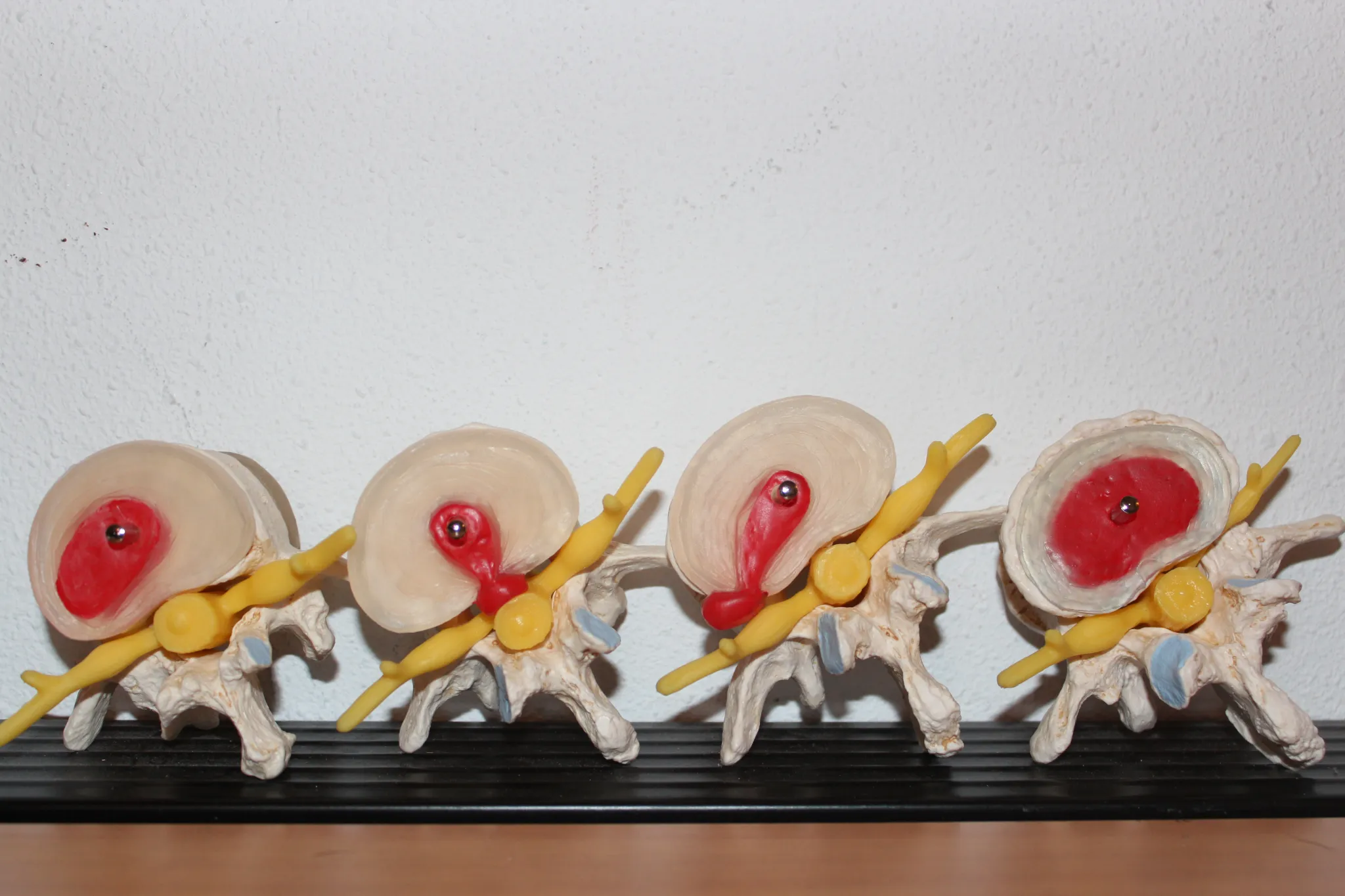 modeles-colonne-vertebrale Modèles de colonne vertébrale pour formation TMS